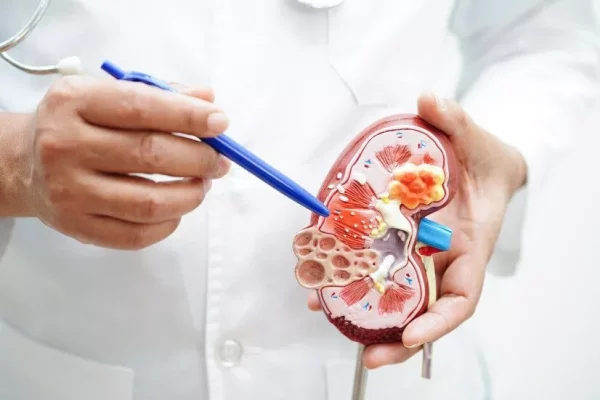 chronic-kidney-disease-doctor-holding-model-treatment-urinary-system-urology-estimated-glomerular-filtration-rate-egfr_622428-5103